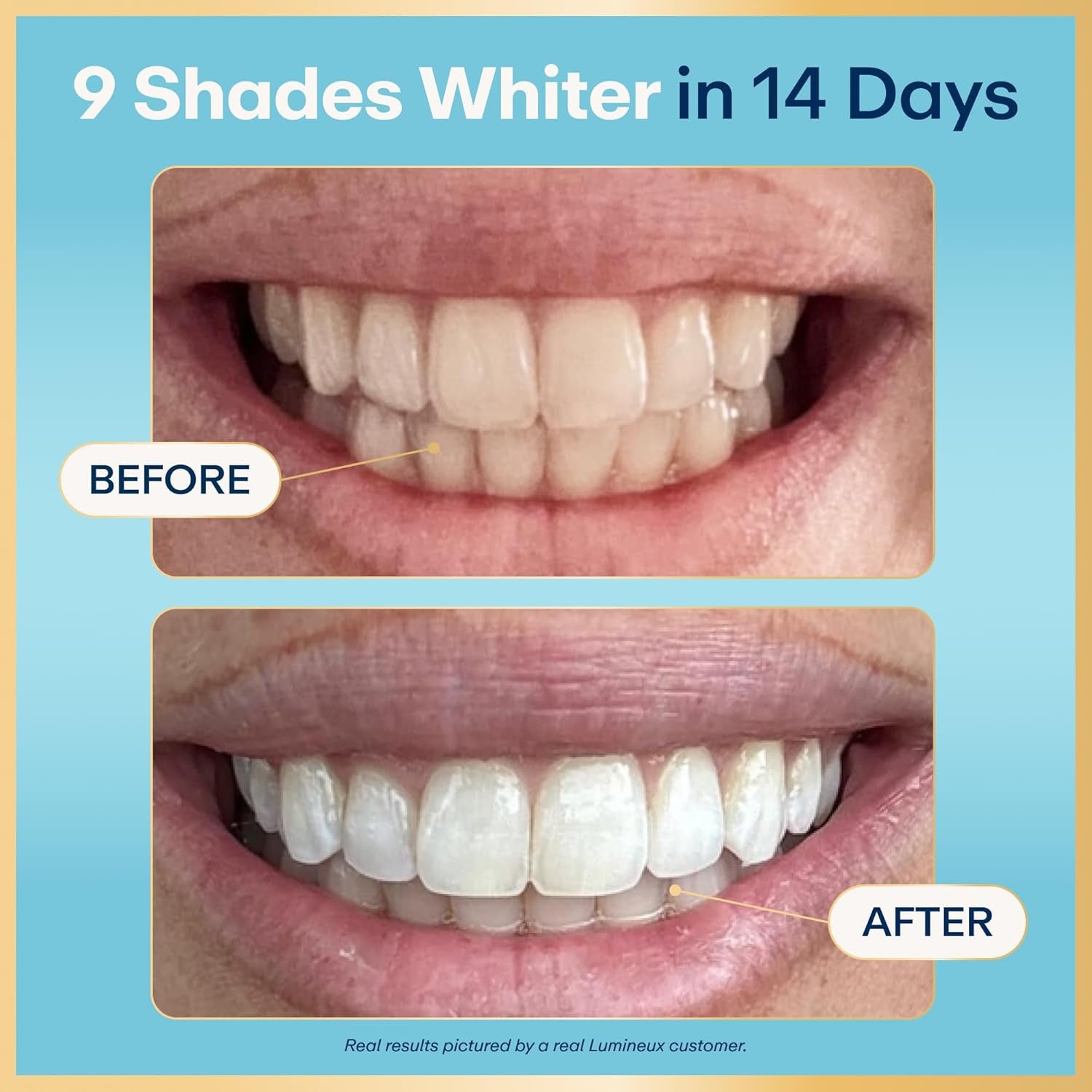 Teeth Whitening Strips - 21 Treatments (3 Months) - Peroxide Free - Enamel Safe for Whiter Teeth - Whitening without the Sensitivity - Dentist Formulated - Sensitivity